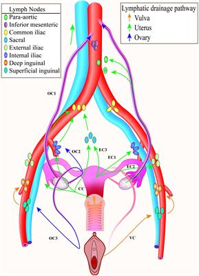 Sentinel Lymph Node Mapping: Current Applications and Future Perspectives in Gynecology Malignant Tumors